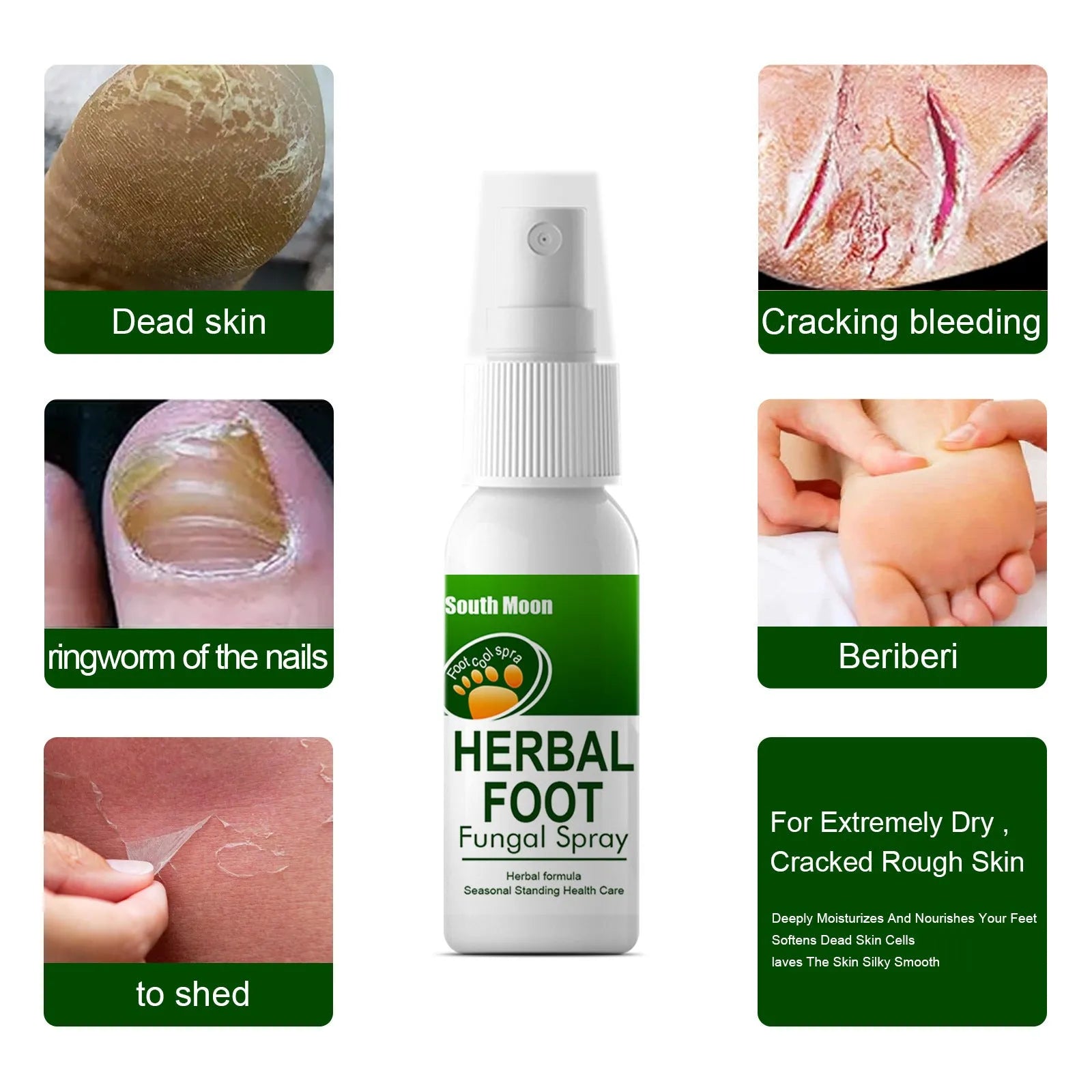 30ml foot spray bottle for nourishing and hydrating foot skin
