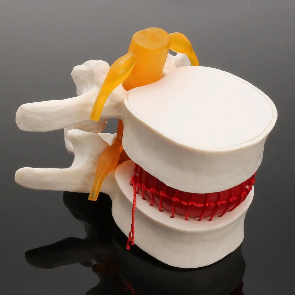 White PVC lumbar intervertebral disc demonstration model for medical teaching