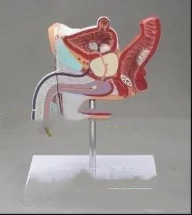 Plastic anatomical model showing male internal reproductive system diseases including benign prostatic hyperplasia.