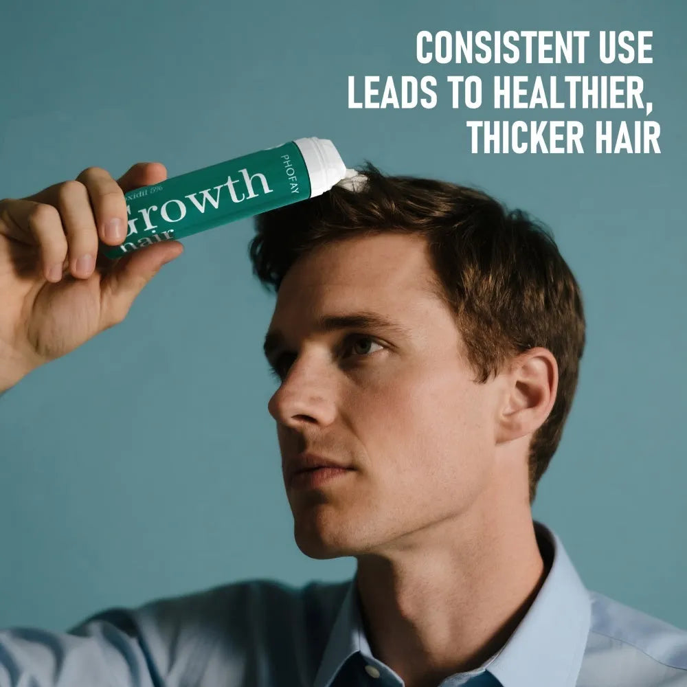 CH004 Minoxidil Anti-Hair Loss Mousse aerosol can, 60g, for topical scalp application.