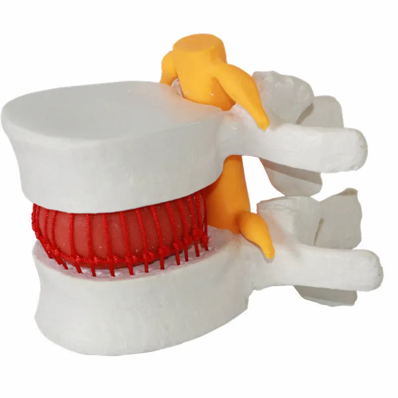 White PVC lumbar intervertebral disc demonstration model for medical teaching