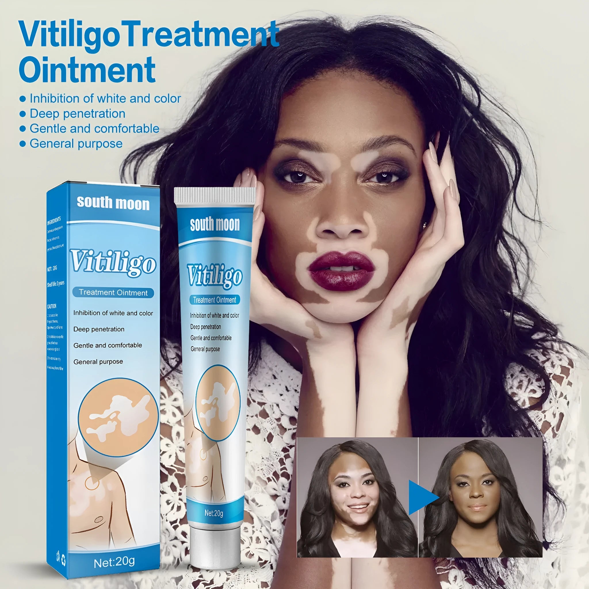 20g Flower Spot Sweat Spot White Cream in boxed packaging for targeted blemish treatment