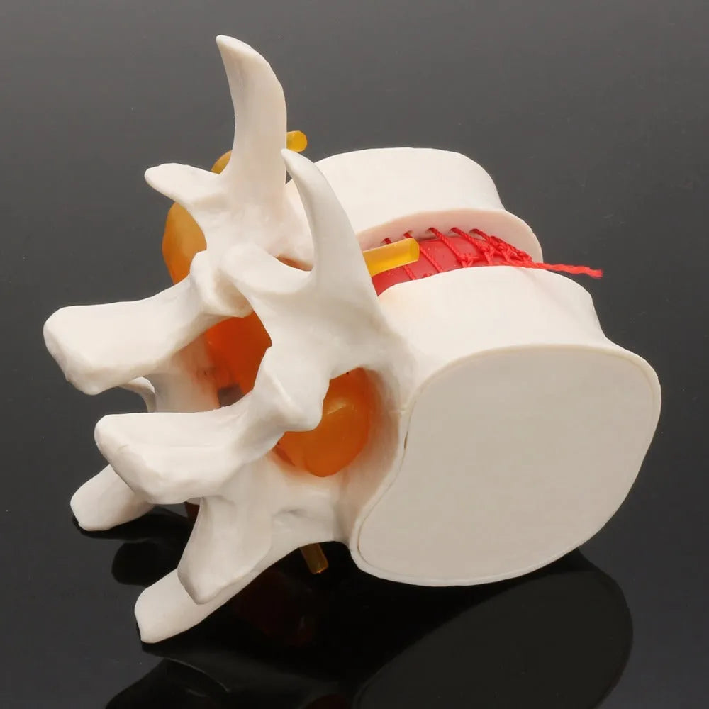 White PVC lumbar intervertebral disc demonstration model for medical teaching