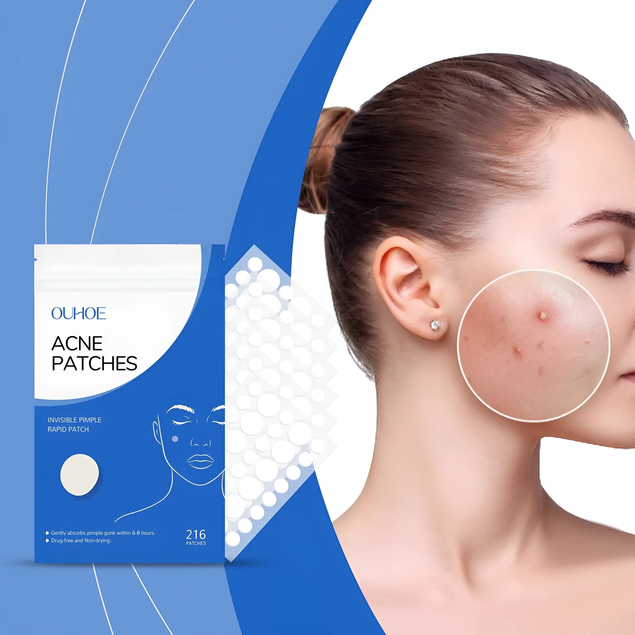Box of 216 hydrocolloid acne patches with tea tree oil and vitamin E for spot treatment