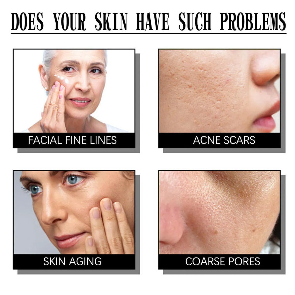 50g jar of salicylate exfoliating and moisturising cream for all skin types.