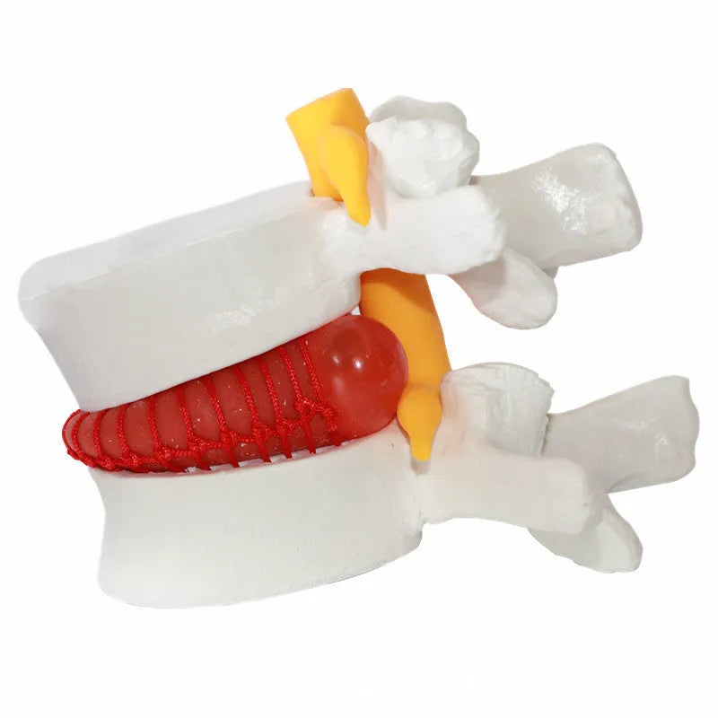 White PVC lumbar intervertebral disc demonstration model for medical teaching