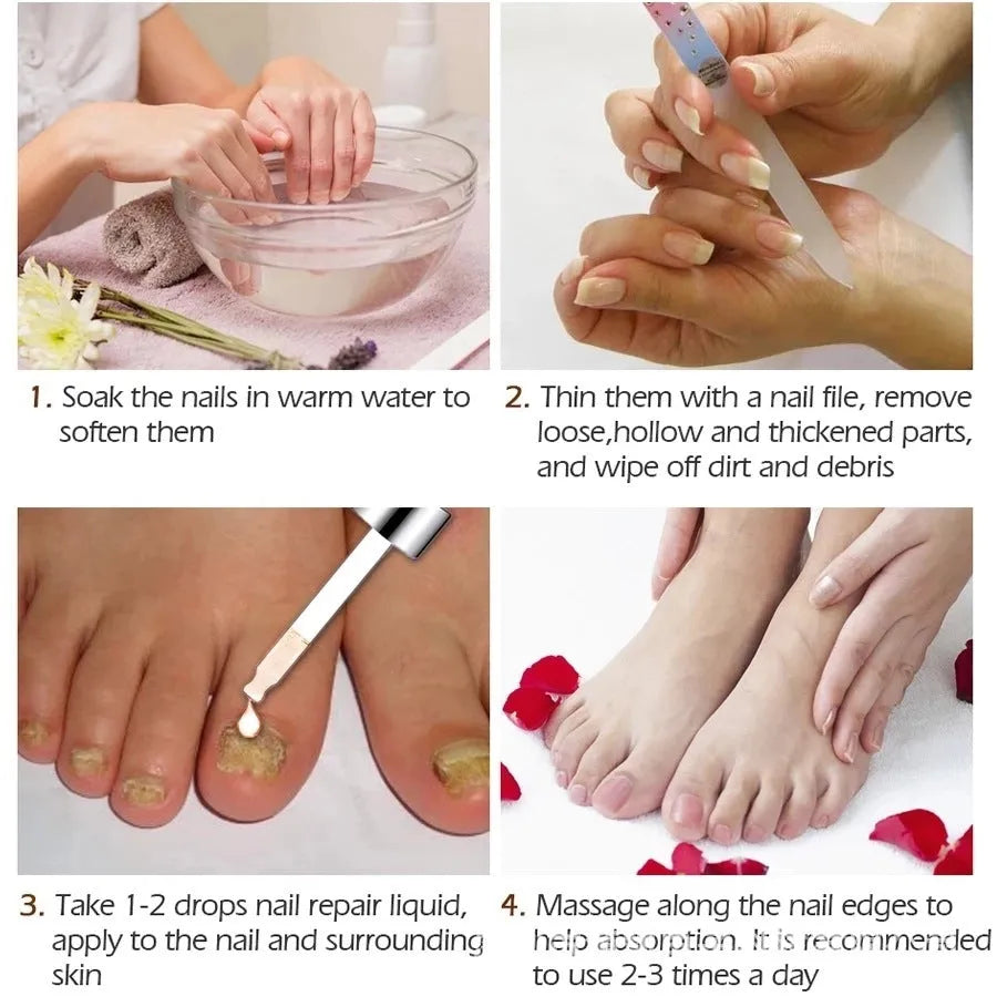 10ml bottle of Deck Antimicrobial Liquid for foot and nail care treatment.