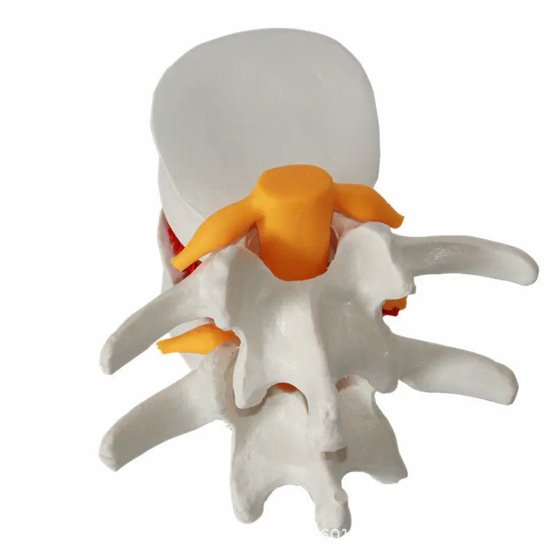 White PVC lumbar intervertebral disc demonstration model for medical teaching