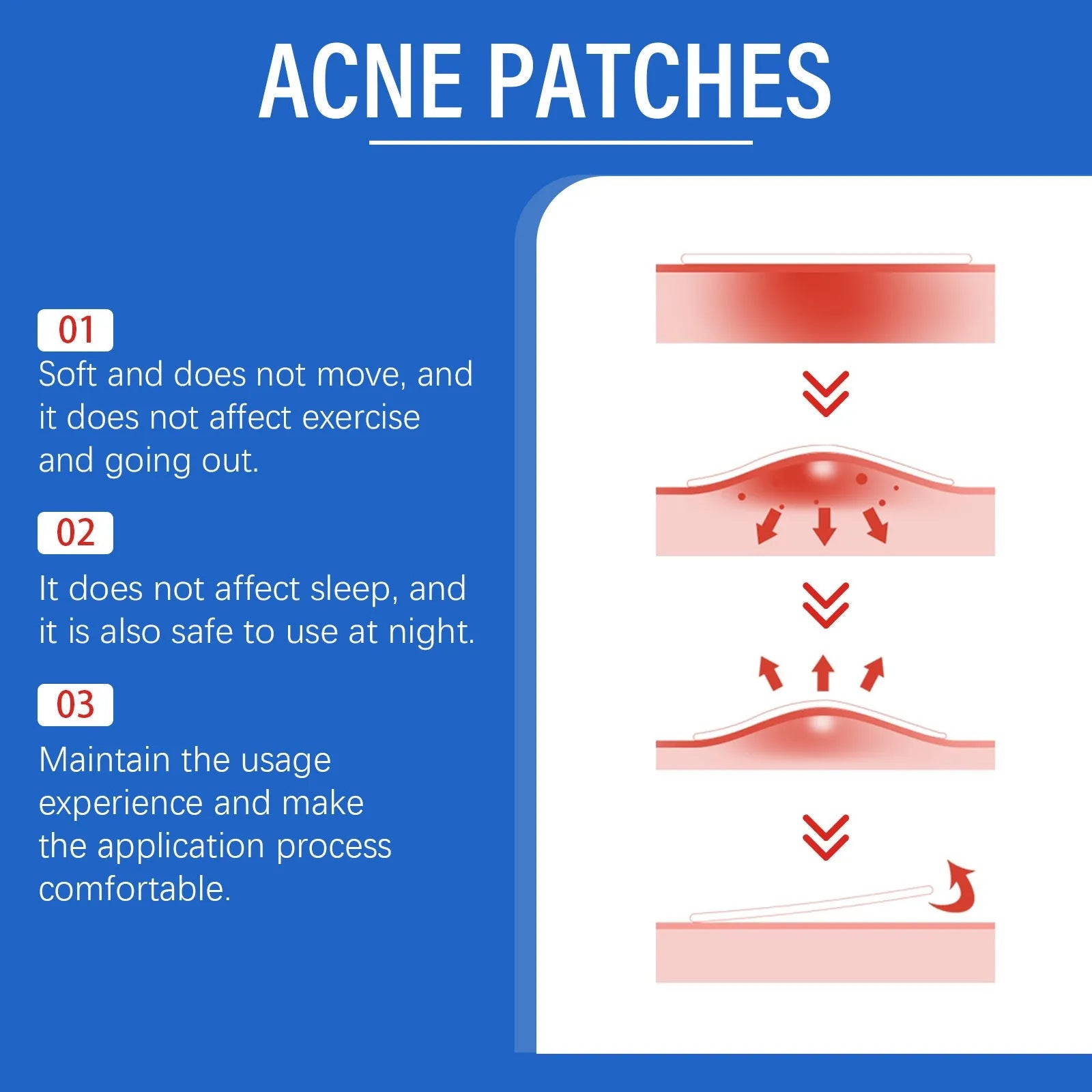 Box of 216 hydrocolloid acne patches with tea tree oil and vitamin E for spot treatment