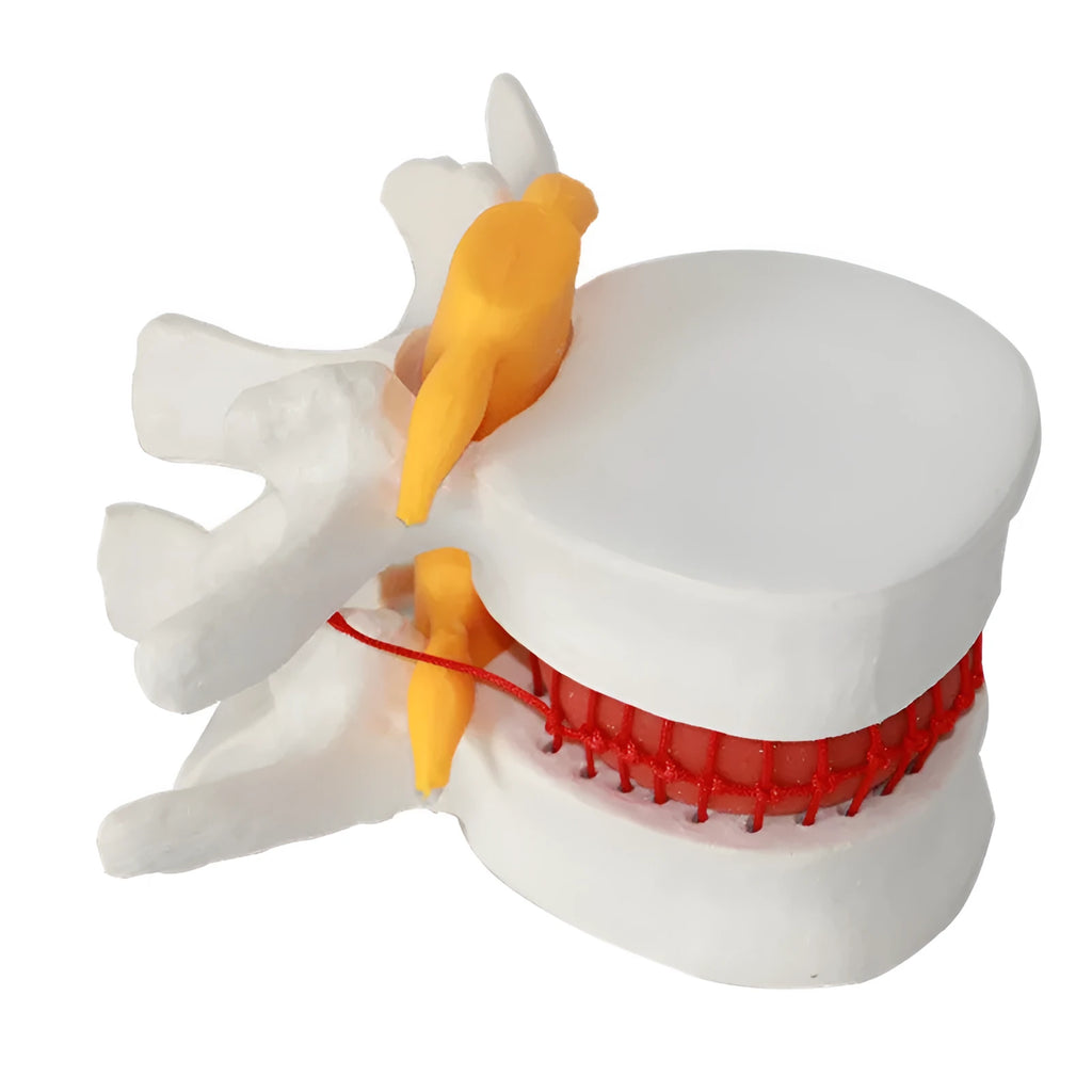 White PVC lumbar intervertebral disc demonstration model for medical teaching