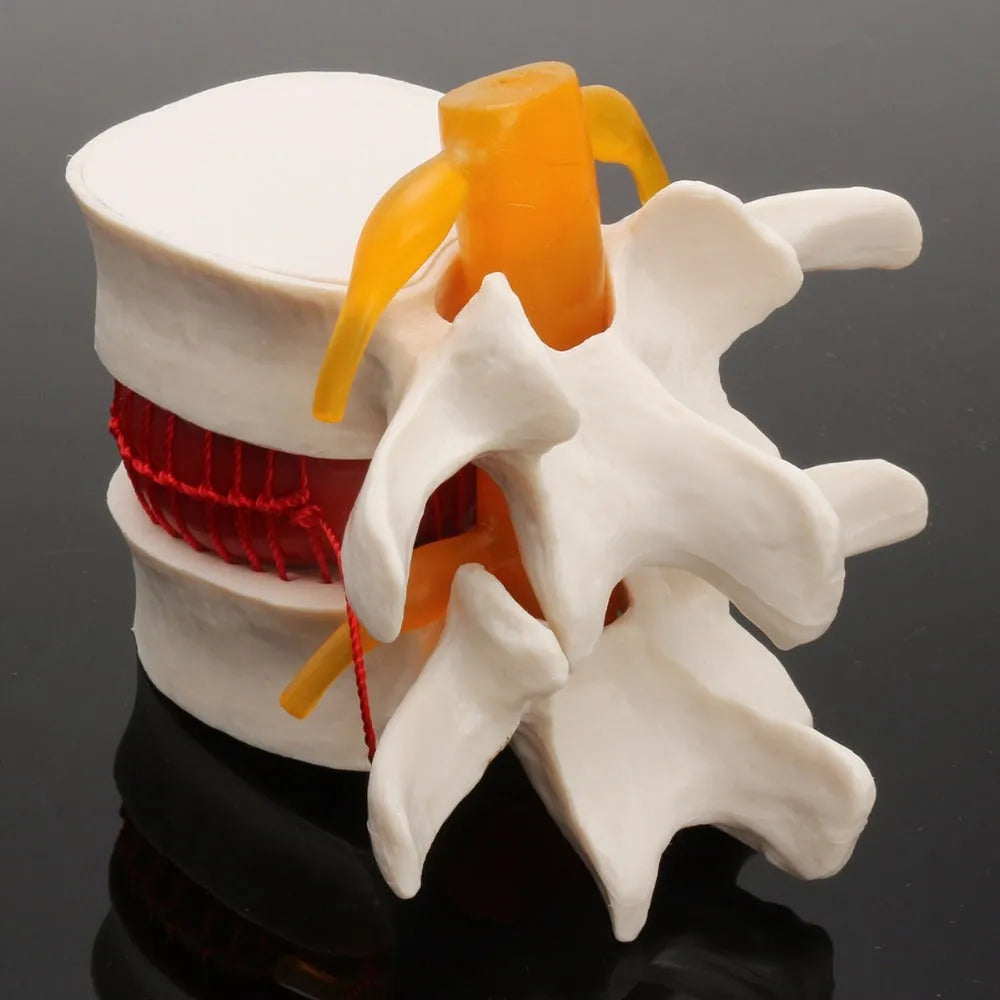 White PVC lumbar intervertebral disc demonstration model for medical teaching