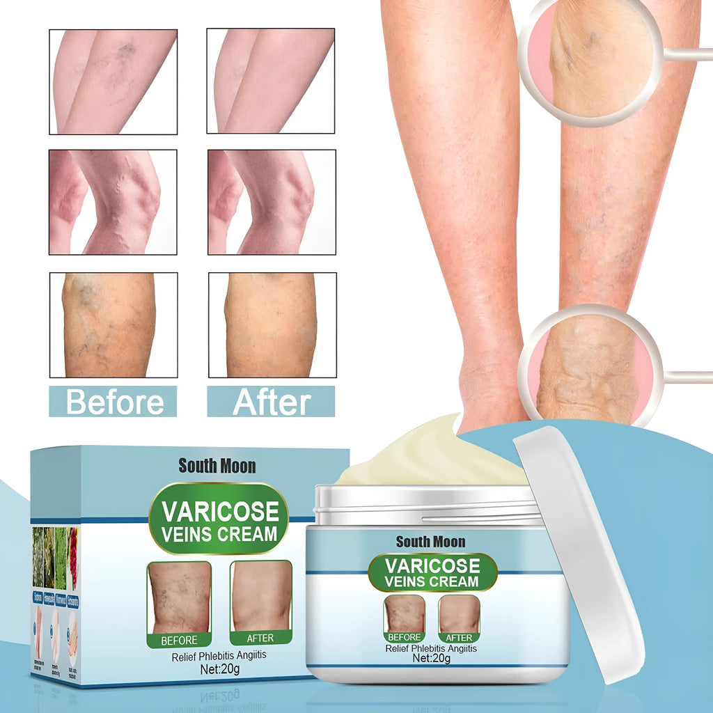 20g vein repair cream container for leg vein treatment and green tendon bulge relief