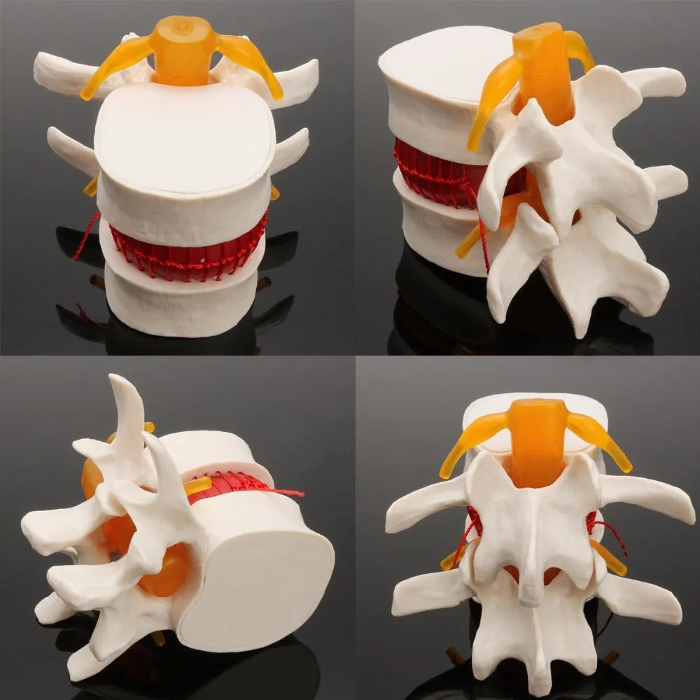 White PVC lumbar intervertebral disc demonstration model for medical teaching