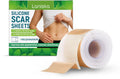 Roll of transparent silicone scar sheet measuring 4cm wide on a skin tone background.