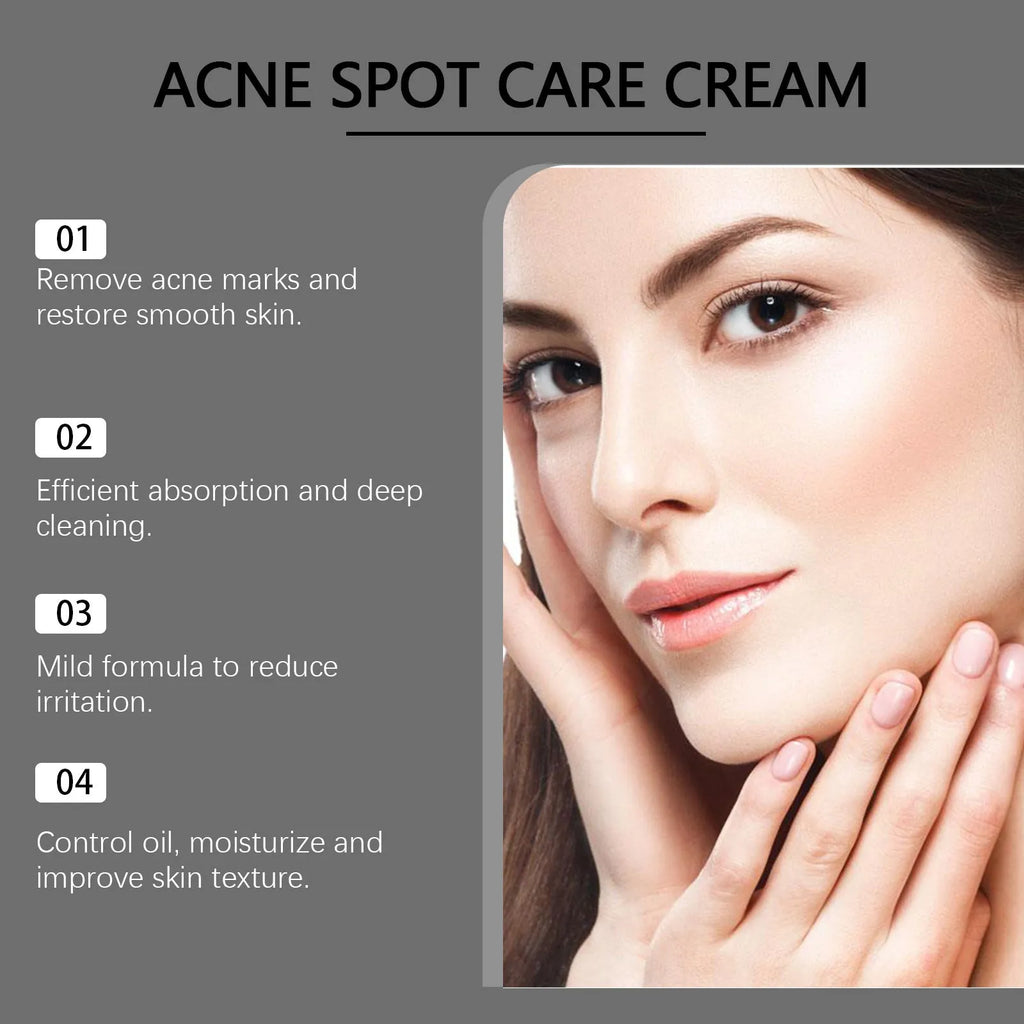 15g tube of acne cream with mint leaf and tea tree oil for facial blemish treatment