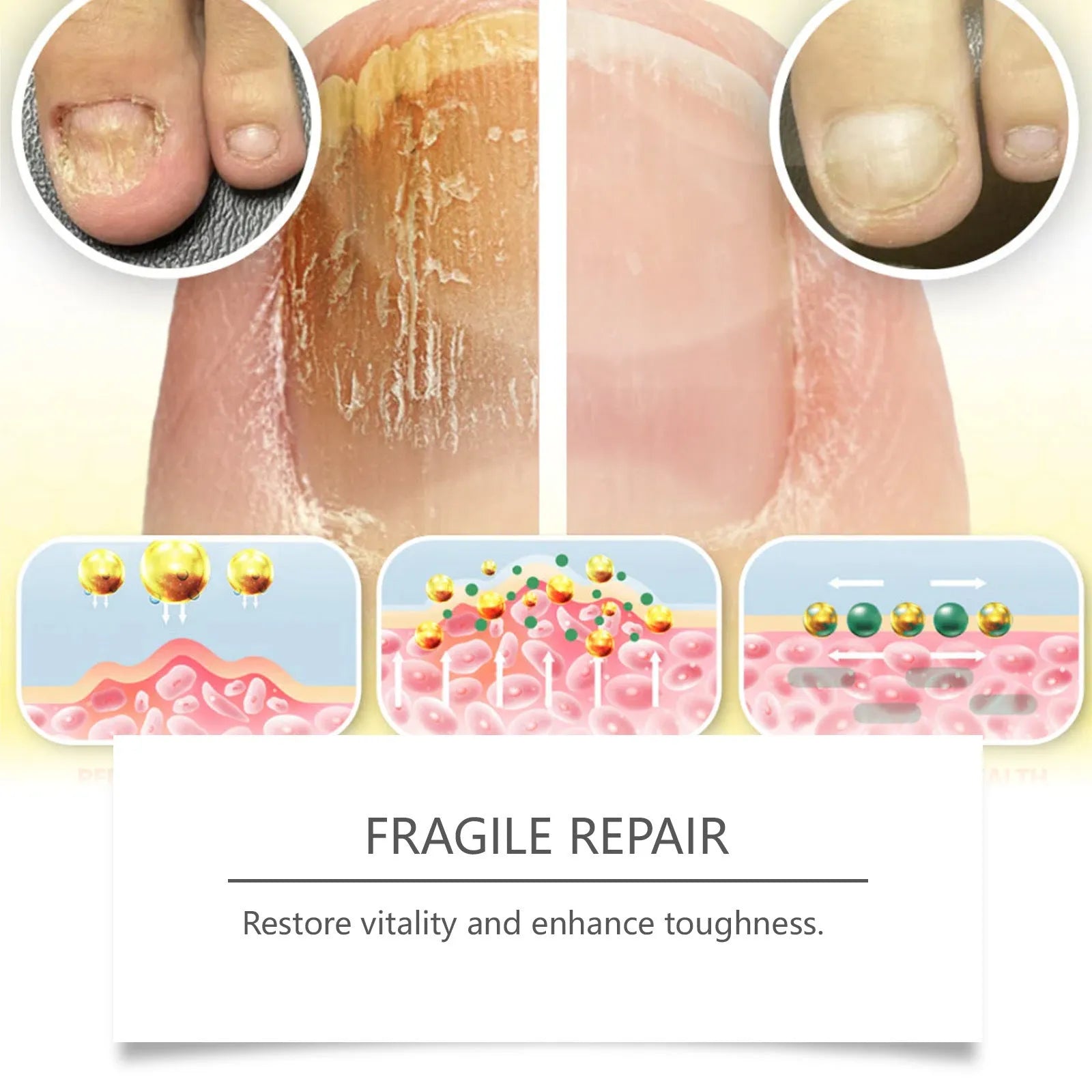 50ml bottle of nail fungus treatment solution with bee venom and peppermint oil