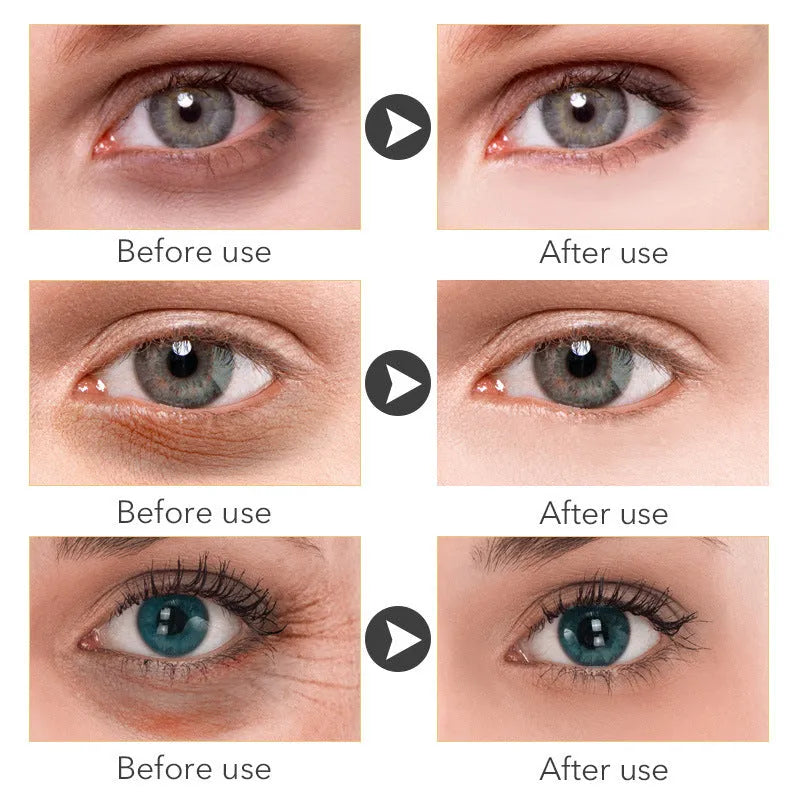 30ml pot of women's eye cream with a separate applicator for dark circle and fine line treatment