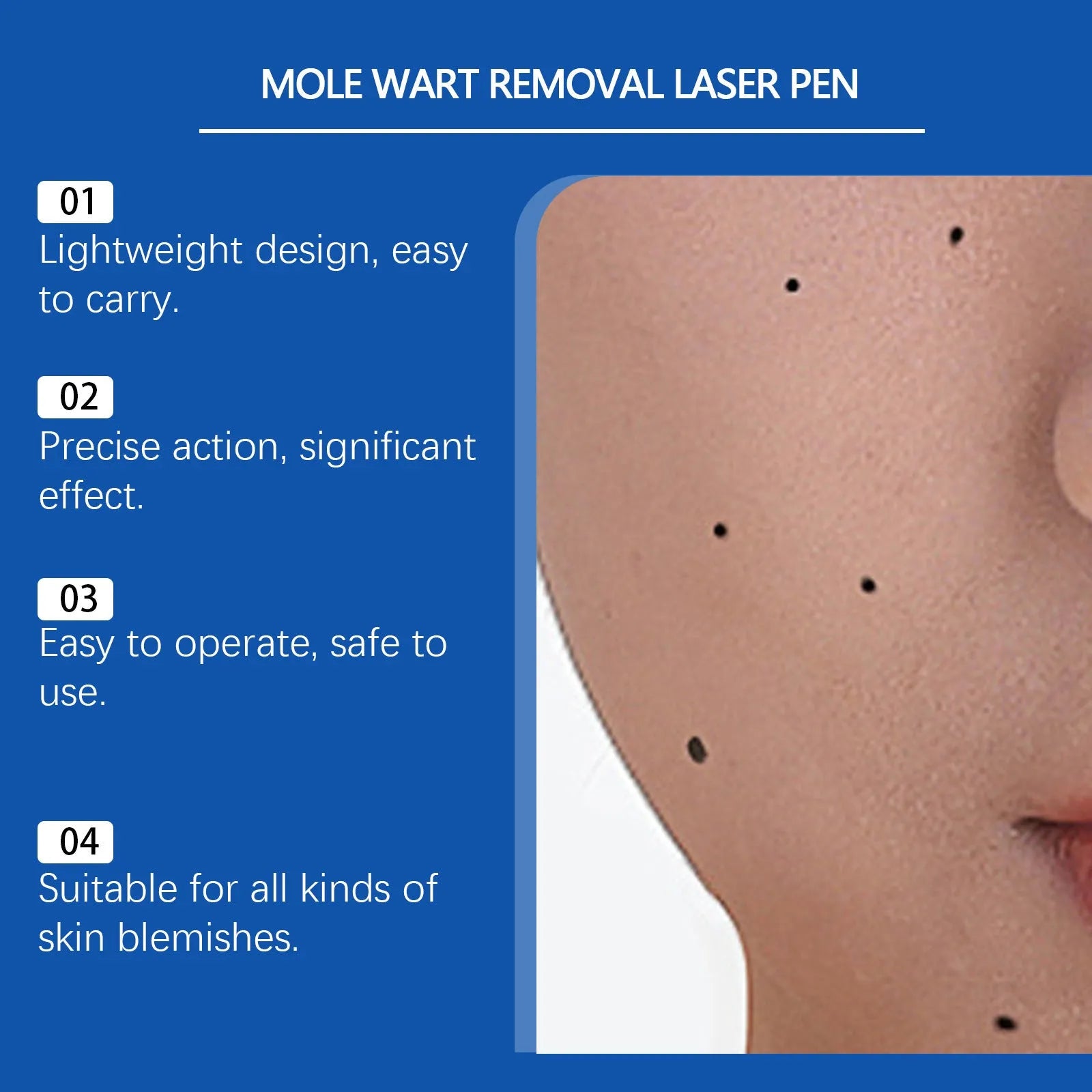 Close-up of a white ABS plastic mole and wart removal laser pen on a plain background.