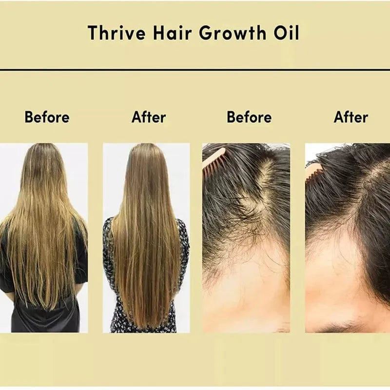 60ml bottle of yellow rosemary hair oil for damaged hair and scalp relief