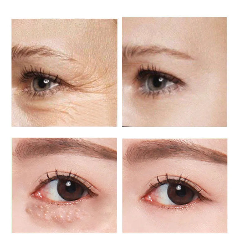 30ml pot of women's eye cream with a separate applicator for dark circle and fine line treatment